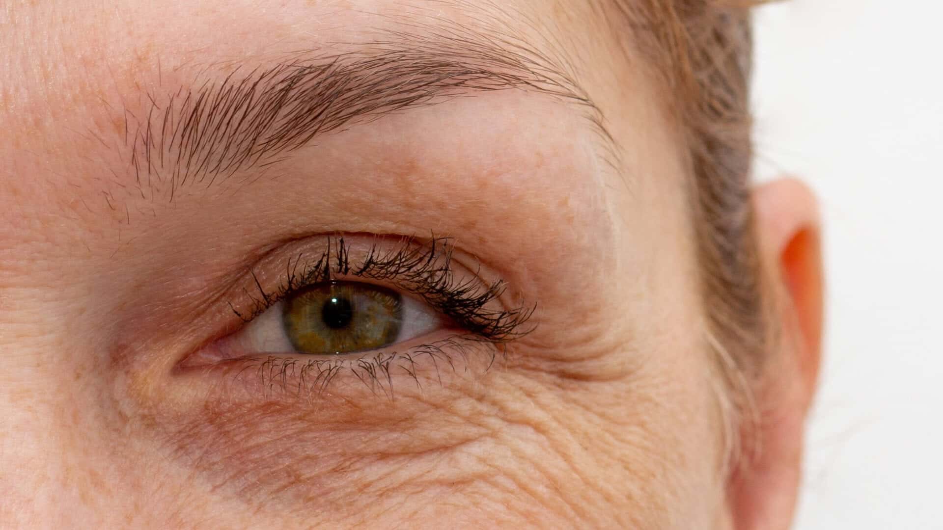 Nahaufnahme eines menschlichen Auges mit feiner Haut und sichtbaren Fältchen.